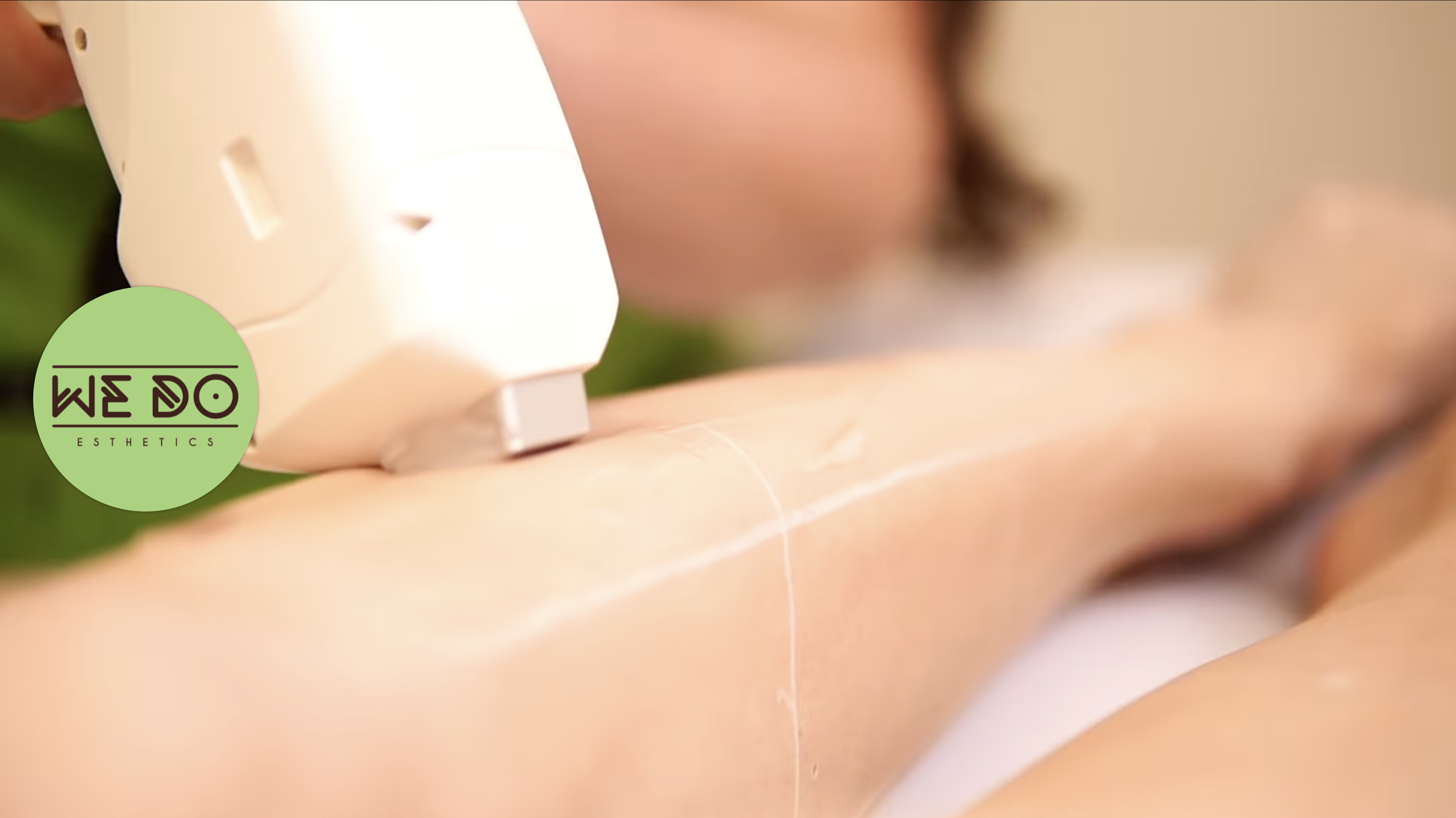 How Much Does Laser Hair Removal Cost in Calgary?